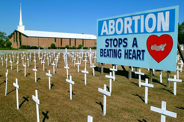 Anti Abortion Pics
